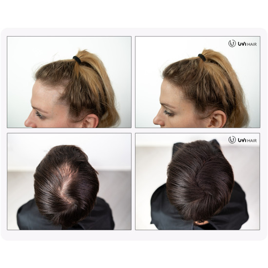 UVI Hair lasna vlakna, LIGHT BROWN / Svijetlo smeđa (veliki 27.5 g, do 50 nanosov) 